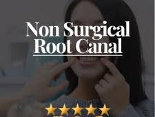 Non-Surgical root canal